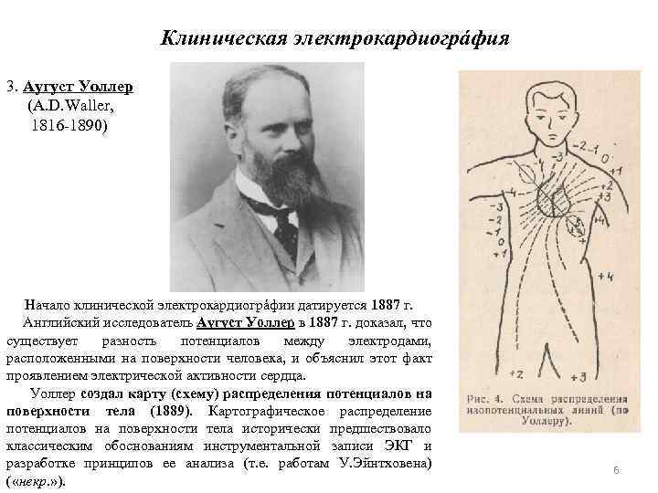 Клиническая электрокардиогрáфия 3. Аугуст Уоллер (A. D. Waller, 1816 1890) Начало клинической электрокардиогрáфии датируется