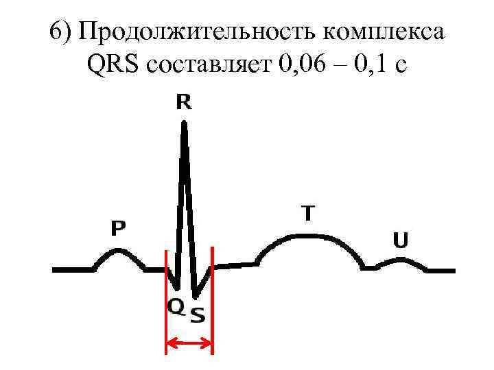 6) Продолжительность комплекса QRS составляет 0, 06 – 0, 1 с 