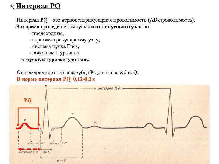 3) Интервал PQ – это атриовентрикулярная проводимость (АВ проводимость). Это время проведения импульсов от