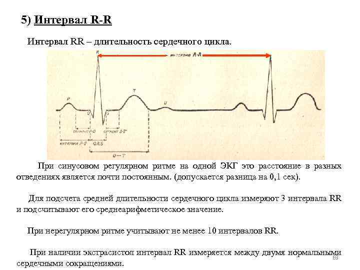 5) Интервал R-R Интервал RR – длительность сердечного цикла. При синусовом регулярном ритме на