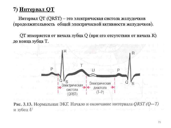 7) Интервал QT (QRST) – это электрическая систола желудочков (продолжительность общей электрической активности желудочков).