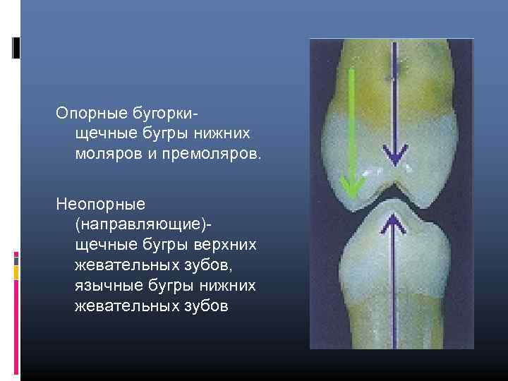 Опорные бугоркищечные бугры нижних моляров и премоляров. Неопорные (направляющие)щечные бугры верхних жевательных зубов, язычные