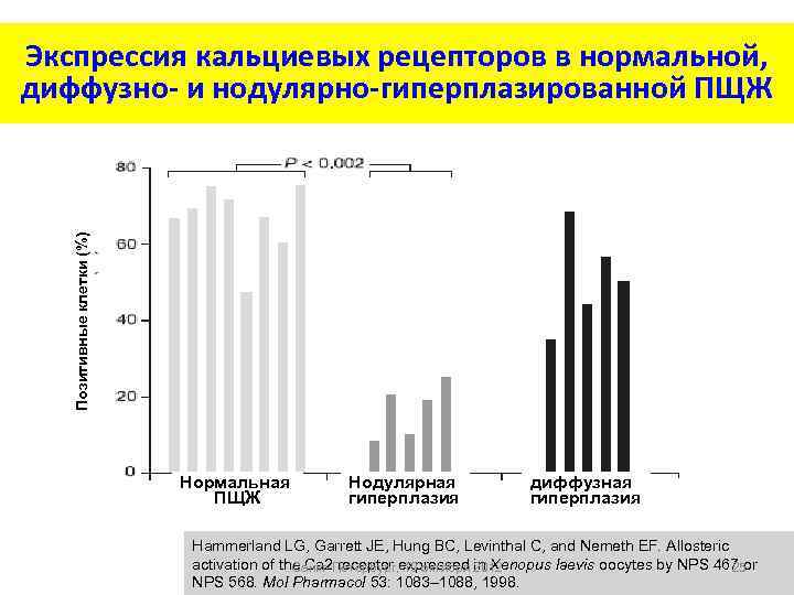 Позитивные клетки (%) Экспрессия кальциевых рецепторов в нормальной, диффузно- и нодулярно-гиперплазированной ПЩЖ Нормальная ПЩЖ