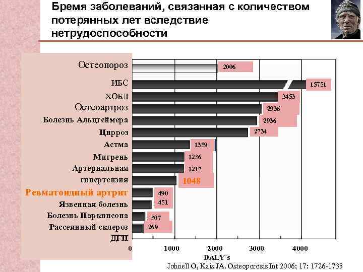 Бремя заболеваний, связанная с количеством потерянных лет вследствие нетрудоспособности Остеопороз 2006 ИБС 15751 ХОБЛ