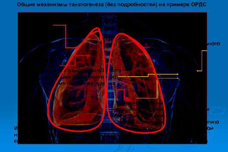 Общие механизмы танатогенеза (без подробностей) на примере ОРДС Высокое внутриплевральное давление – основа снижения