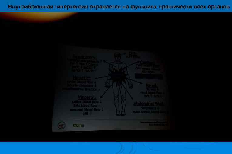 Внутрибрюшная гипертензия отражается на функциях практически всех органов 