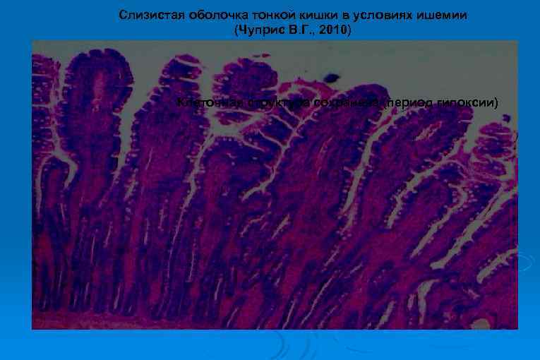 Слизистая оболочка тонкой кишки в условиях ишемии (Чуприс В. Г. , 2010) Клеточная структура
