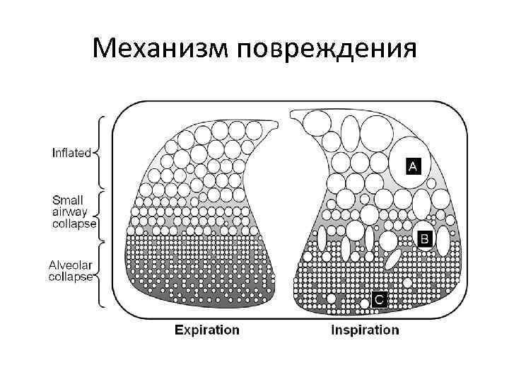 Механизм повреждения 