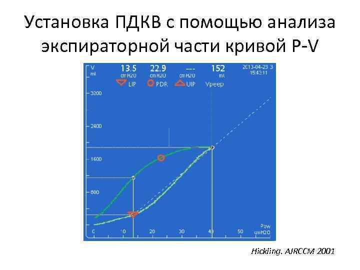 Установка ПДКВ с помощью анализа экспираторной части кривой P-V Hickling. AJRCCM 2001 