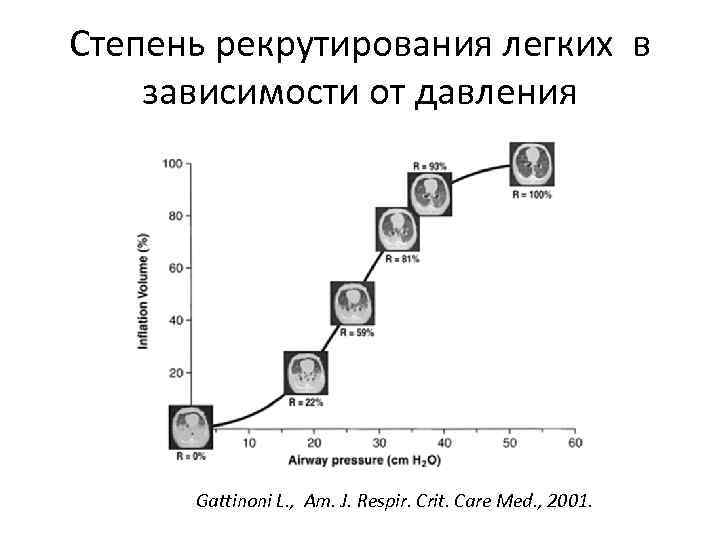 Степень рекрутирования легких в зависимости от давления Gattinoni L. , Am. J. Respir. Crit.