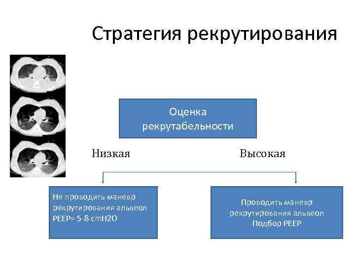 Стратегия рекрутирования Оценка рекрутабельности Низкая Не проводить маневр рекрутирования альвеол PEEP= 5 -8 cm.
