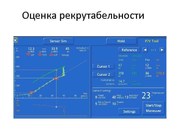 Оценка рекрутабельности 