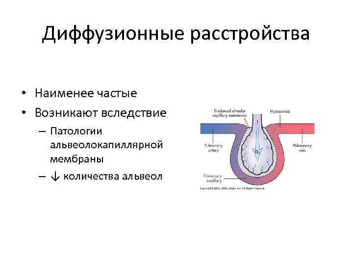 Диффузионные расстройства • Наименее частые • Возникают вследствие – Патологии альвеолокапиллярной мембраны – ↓