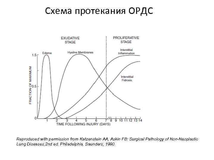 Схема протекания ОРДС Reproduced with permission from Katzenstein AA, Askin FB: Surgical Pathology of