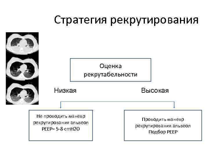 Стратегия рекрутирования Оценка рекрутабельности Низкая Не проводить маневр рекрутирования альвеол PEEP= 5 -8 cm.