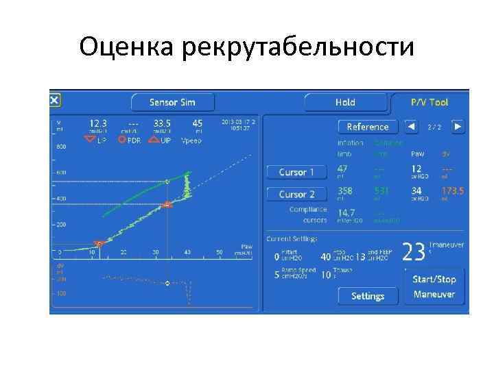 Оценка рекрутабельности 