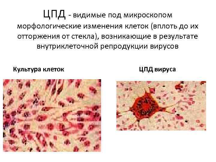 ЦПД - видимые под микроскопом морфологические изменения клеток (вплоть до их отторжения от стекла),