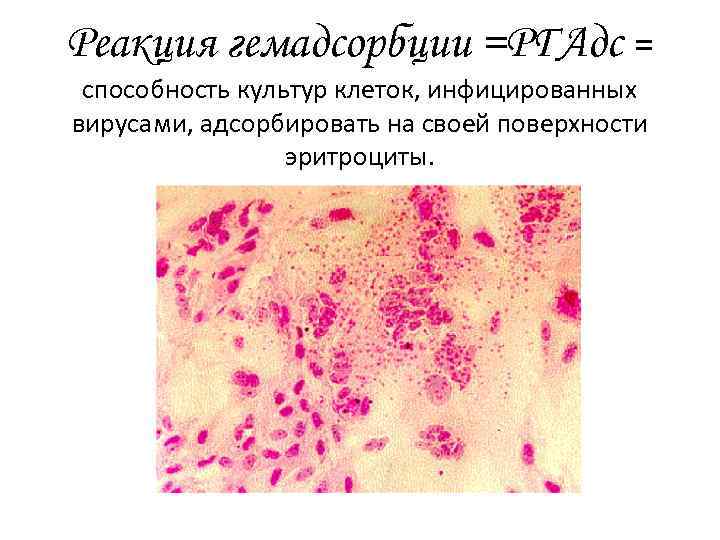 Реакция гемадсорбции =РГАдс = способность культур клеток, инфицированных вирусами, адсорбировать на своей поверхности эритроциты.