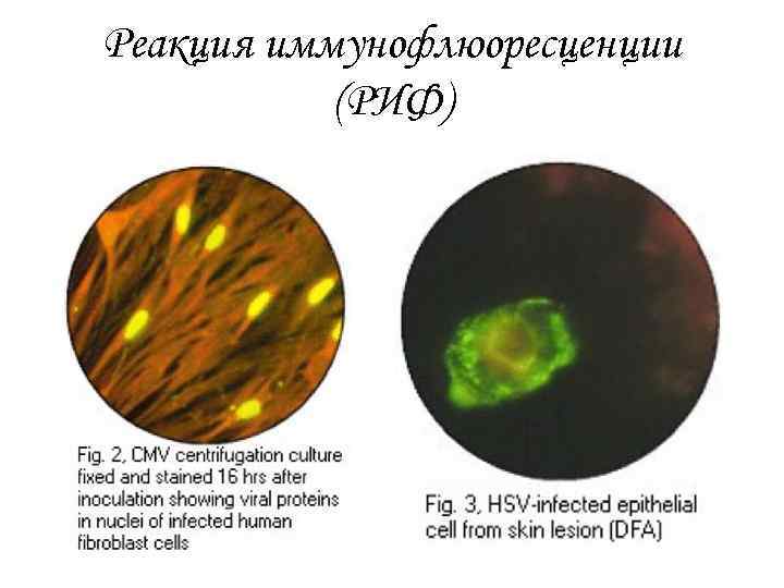 Реакция иммунофлюоресценции (РИФ) 