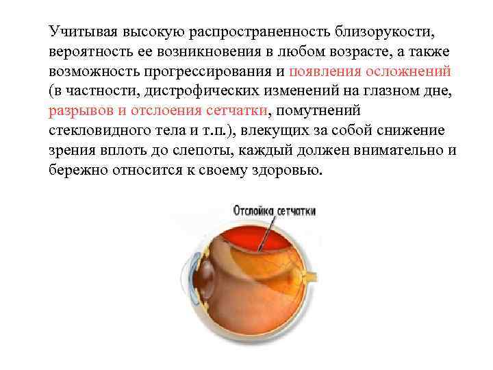 Учитывая высокую распространенность близорукости, вероятность ее возникновения в любом возрасте, а также возможность прогрессирования