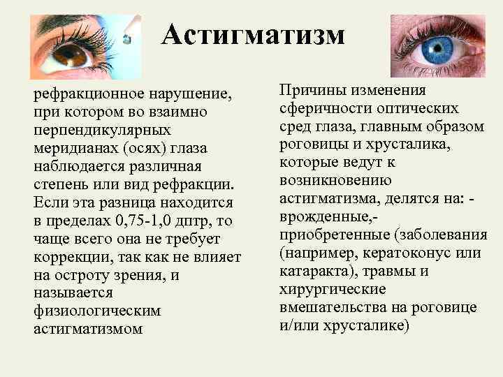 Слово астигматизм. Астигматизм нарушение рефракции глаза при котором. Астигматизм распространенность. Астигматизм причины возникновения. Причины появления астигматизма.