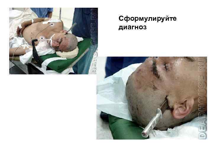 Сформулируйте диагноз 