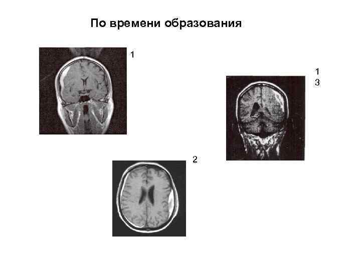 По времени образования 1 1 3 2 