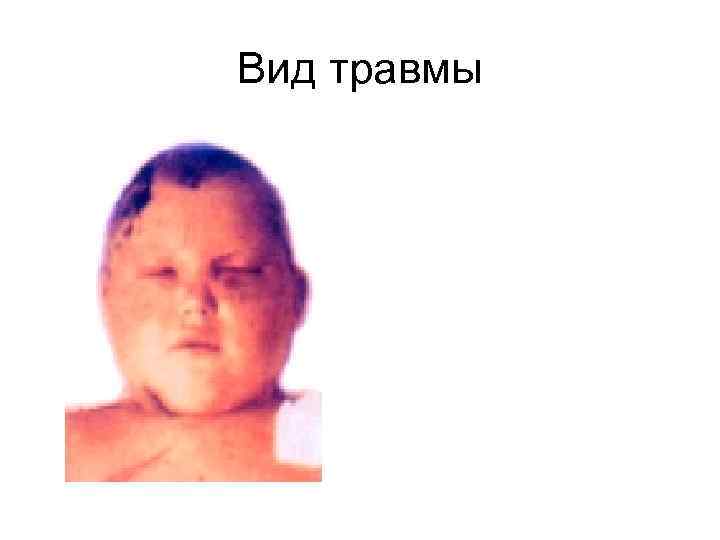 Вид травмы 