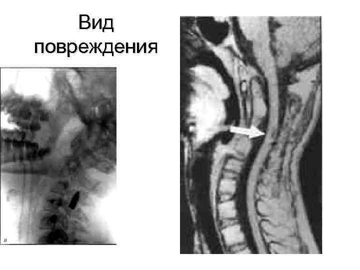 Вид повреждения 