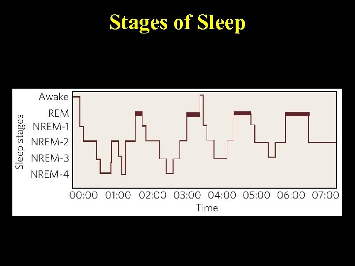 Stages of Sleep 