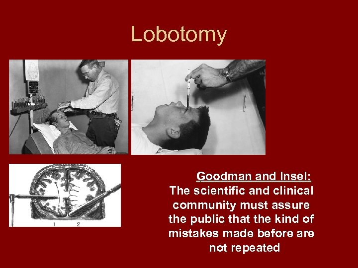 Lobotomy Goodman and Insel: The scientific and clinical community must assure the public that