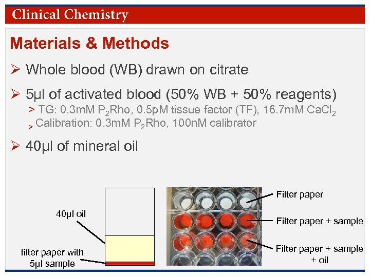 Materials & Methods Ø Whole blood (WB) drawn on citrate Ø 5µl of activated