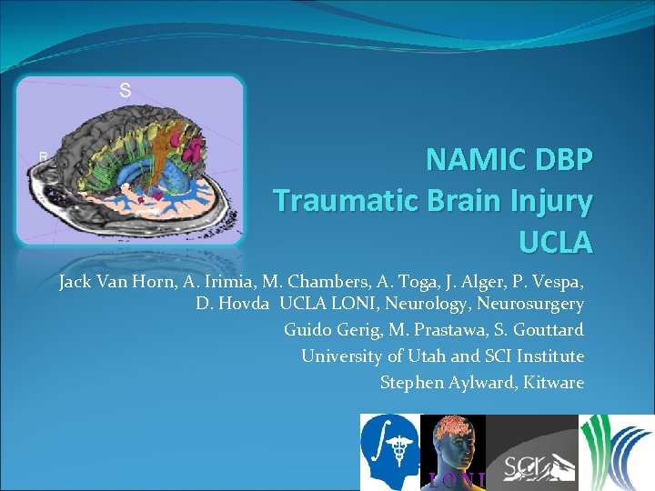 NAMIC DBP Traumatic Brain Injury UCLA Jack Van Horn, A. Irimia, M. Chambers, A.