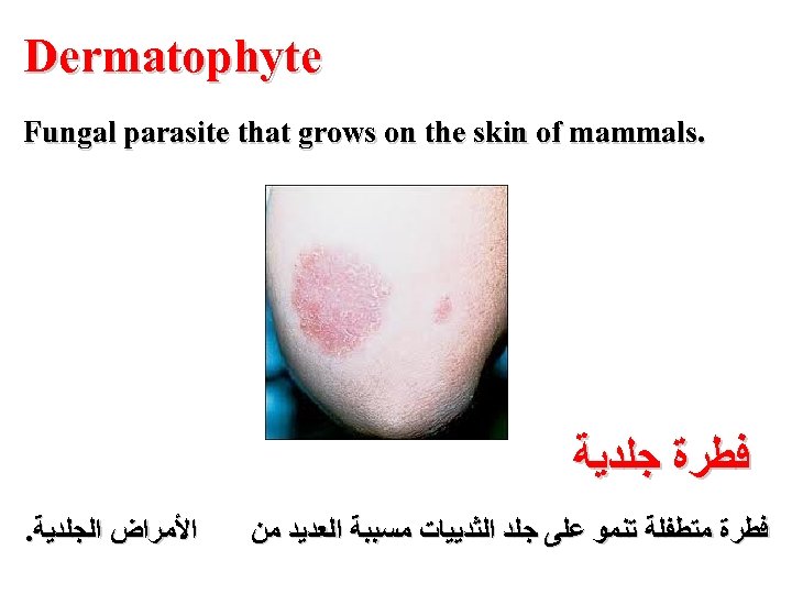  Dermatophyte . Fungal parasite that grows on the skin of mammals ﻓﻄﺮﺓ ﺟﻠﺪﻳﺔ