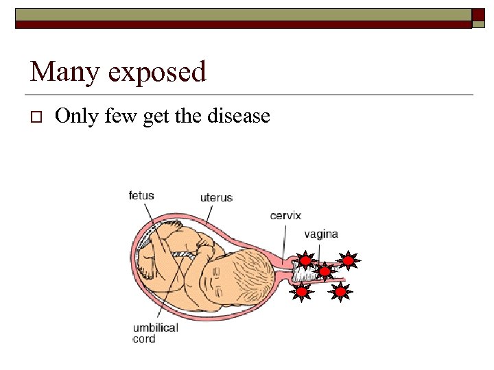 Many exposed o Only few get the disease 