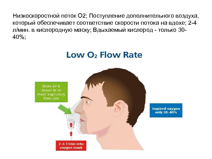 Низкоскоростной поток О 2; Поступление дополнительного воздуха, который обеспечивает соответствие скорости потока на вдохе;