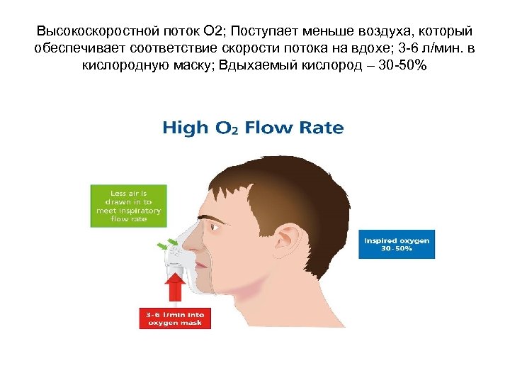 Высокоскоростной поток О 2; Поступает меньше воздуха, который обеспечивает соответствие скорости потока на вдохе;