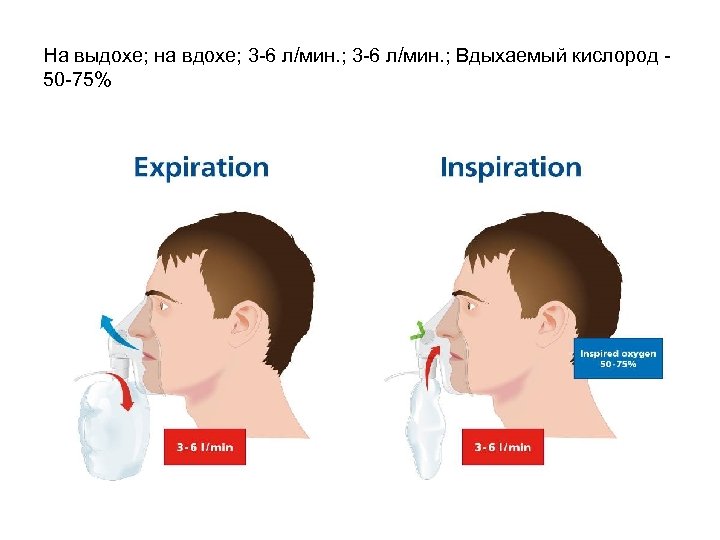 На выдохе; на вдохе; 3 -6 л/мин. ; Вдыхаемый кислород 50 -75% 