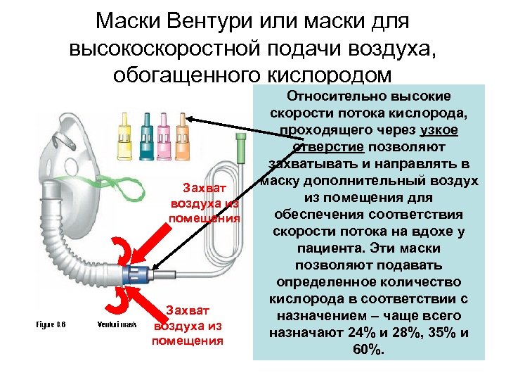 Маски Вентури или маски для высокоскоростной подачи воздуха, обогащенного кислородом Захват воздуха из помещения