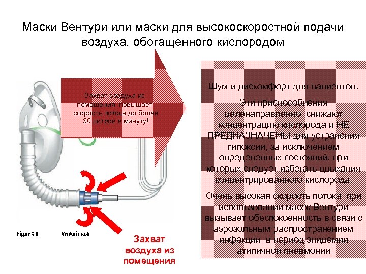 Маски Вентури или маски для высокоскоростной подачи воздуха, обогащенного кислородом Шум и дискомфорт для