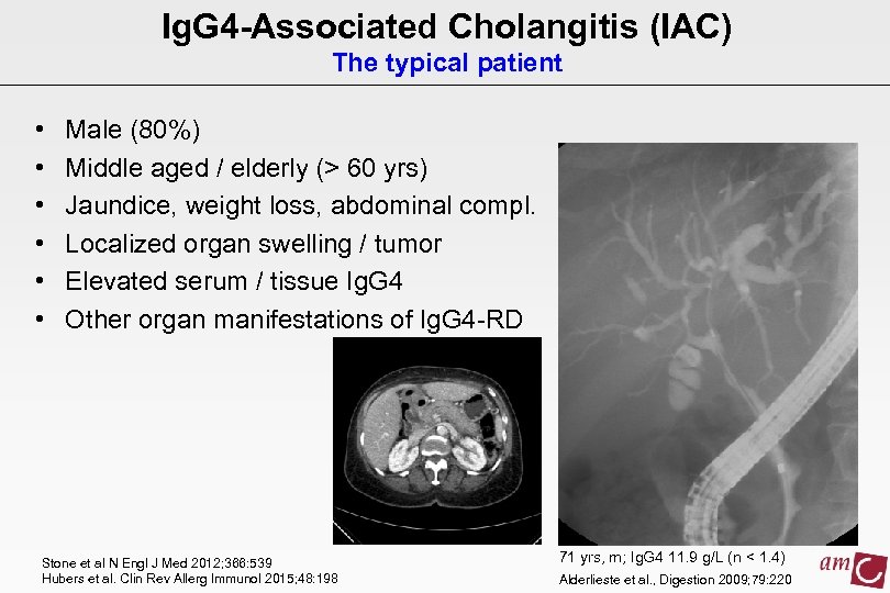 Ig. G 4 -Associated Cholangitis (IAC) The typical patient • • • Male (80%)