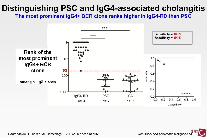 Distinguishing PSC and Ig. G 4 -associated cholangitis The most prominent Ig. G 4+