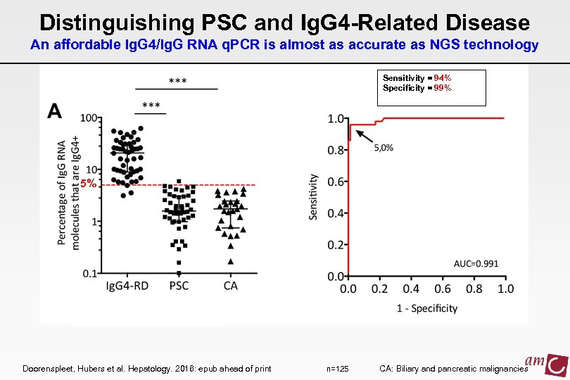 Distinguishing PSC and Ig. G 4 -Related Disease An affordable Ig. G 4/Ig. G