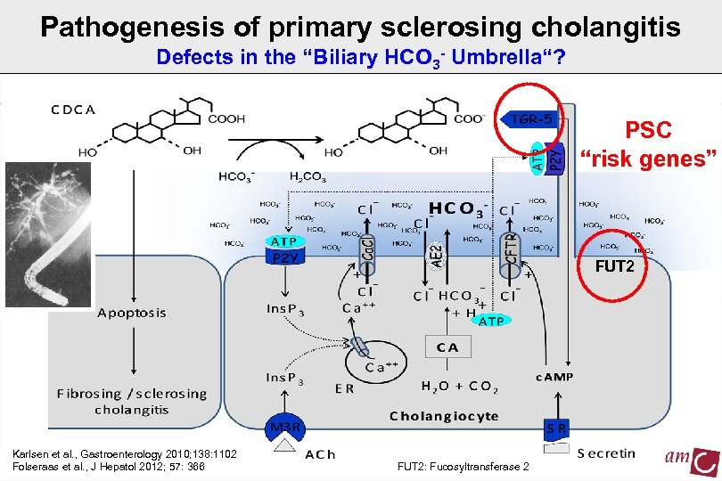 Pathogenesis of primary sclerosing cholangitis Defects in the “Biliary HCO 3 - Umbrella“? PSC