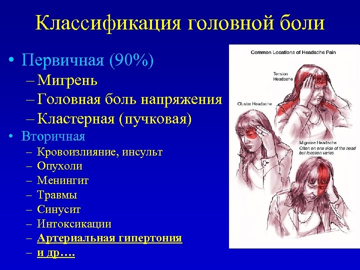 Классификация головной боли • Первичная (90%) – Мигрень – Головная боль напряжения – Кластерная