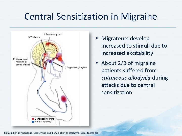 Central Sensitization in Migraine • Migrateurs develop increased to stimuli due to increased excitability