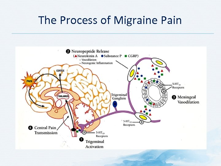 The Process of Migraine Pain 