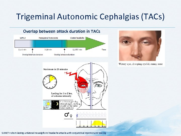 Trigeminal Autonomic Cephalgias (TACs) Overlap between attack duration in TACs SUNCT = short-lasting unilateral