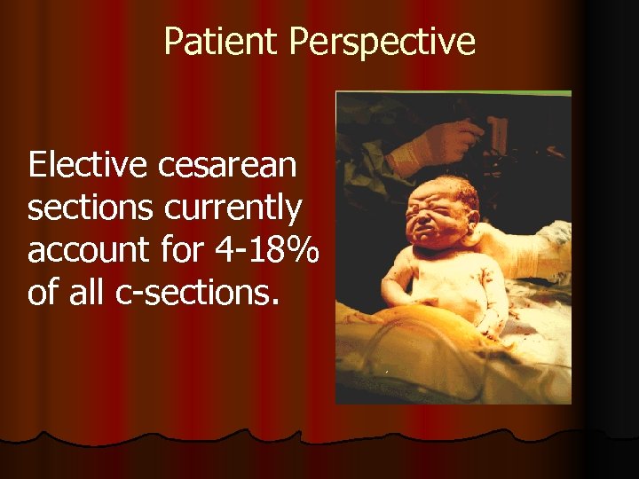 Patient Perspective Elective cesarean sections currently account for 4 -18% of all c-sections. 