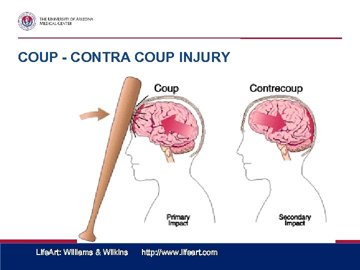 COUP - CONTRA COUP INJURY Life. Art: Williams & Wilkins http: //www. lifeart. com